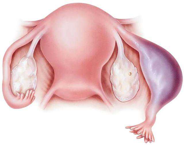 重庆代生孩子零风险 重庆市妇幼保健院试管婴儿包含了哪些? ‘孕妇nt值看男女