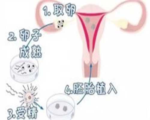 重庆供卵试管公司哪里最专业 在重庆做三代试管婴儿大概多少钱? ‘男士b超单