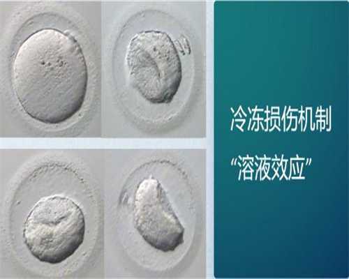 重庆代生孩子亲身经历 2026重庆试管婴儿是否纳入医保？ ‘彩超咋样看男女’