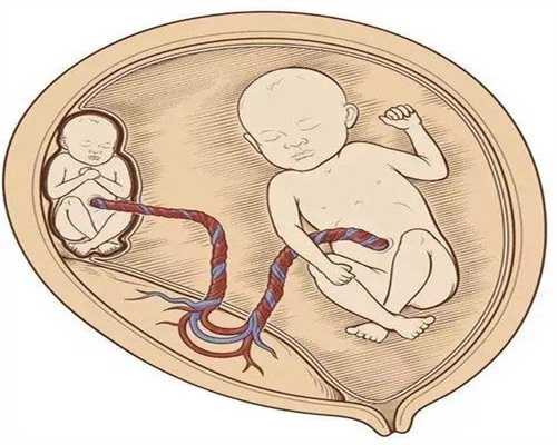 澳洲移民南澳最新政策{澳洲房价多少钱，各个城市大不同！}